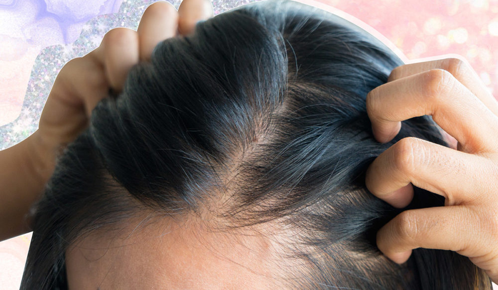 Postpartum Hair Loss And How To Deal With It Everyday Healthy News